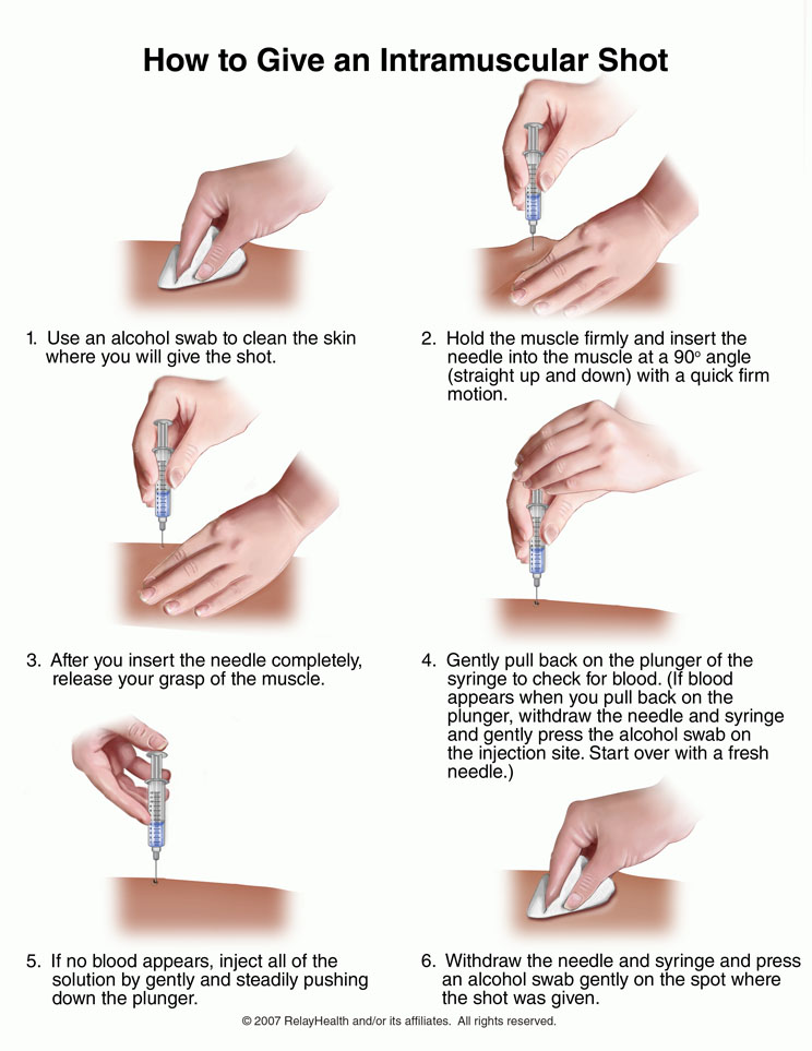 Intramuscular Shot, How to Give: Illustration