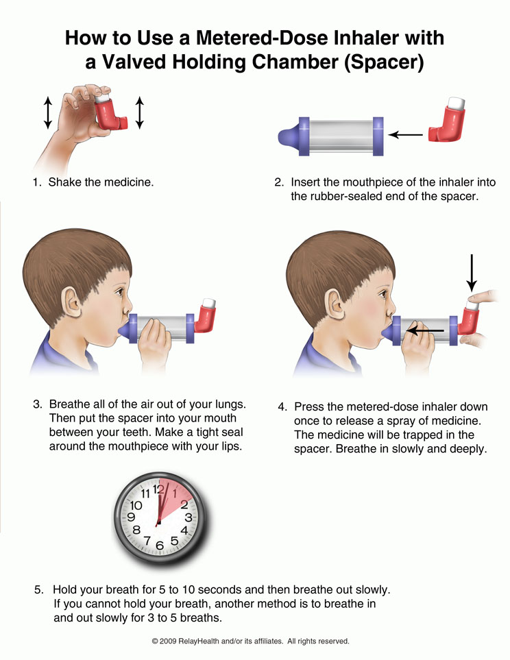 Metered-Dose Inhaler, How to Use with a Spacer: Illustration