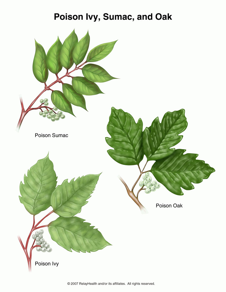 Poison Ivy, Sumac, and Oak: Illustration