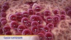 Thumbnail image of: Cancer Cell Growth (Animation)