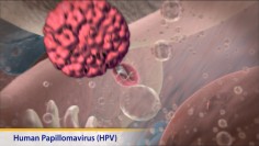 Thumbnail image of: Human Papillomavirus (HPV) (Animation)