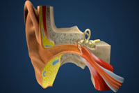 Thumbnail image of: Hearing Loss (Animation)