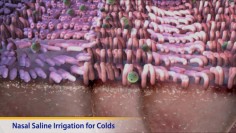 Thumbnail image of: Nasal Saline Irrigation for Colds (Animation)