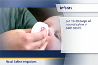 Thumbnail image of: Nasal Saline Irrigations (pediatric) (Animation)