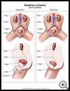 Thumbnail image of: Sistema urinario: ilustración