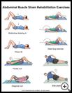 Thumbnail image of: Abdominal Muscle Strain Exercises: Illustration
