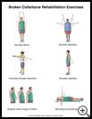 Thumbnail image of: Collarbone Fracture Exercises, Page 2: Illustration