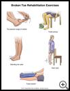 Thumbnail image of: Toe Fracture Exercises: Illustration