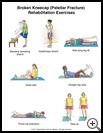 Thumbnail image of: Kneecap Fracture Exercises, Page 1: Illustration