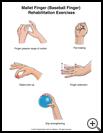 Thumbnail image of: Mallet Finger (Baseball Finger) Exercises: Illustration