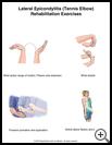 Thumbnail image of: Tennis Elbow Exercises, Page 1: Illustration