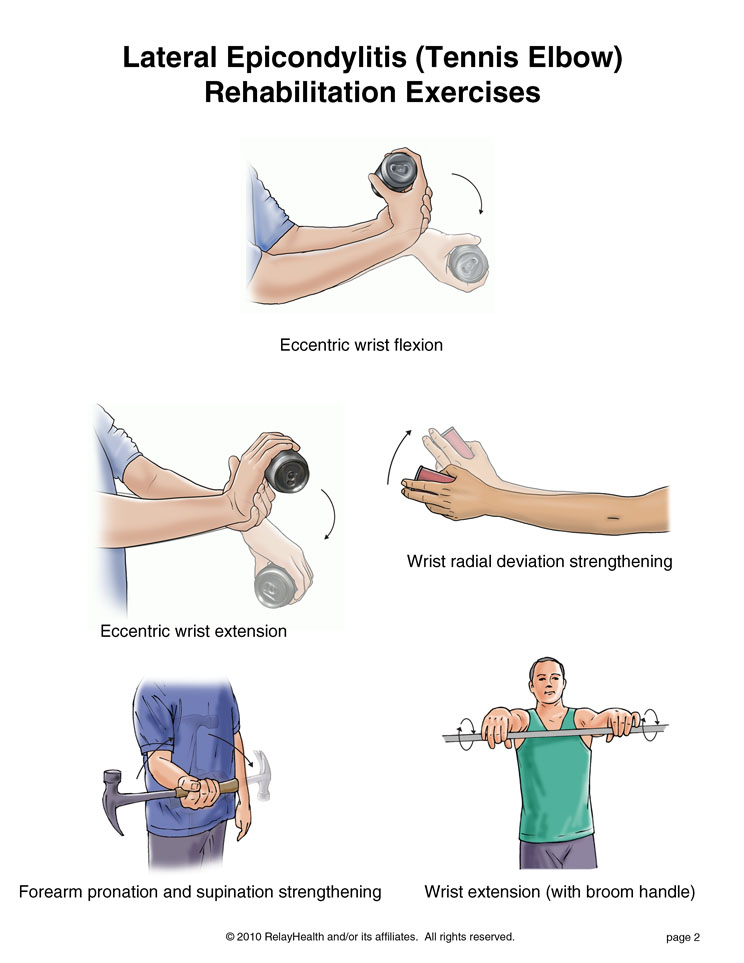 Tennis Elbow Exercises, Page 2: Illustration